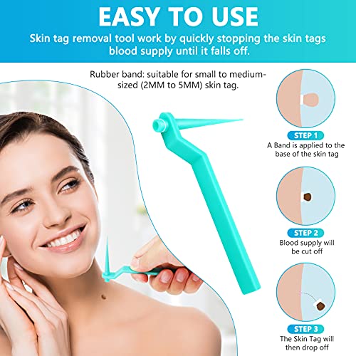 Micro Skin Tag Remover Kit with 20 micro bands Safe and Безболезнен, Skin Tag Remover, Mole Отстраняване, Топ-Grade Skin