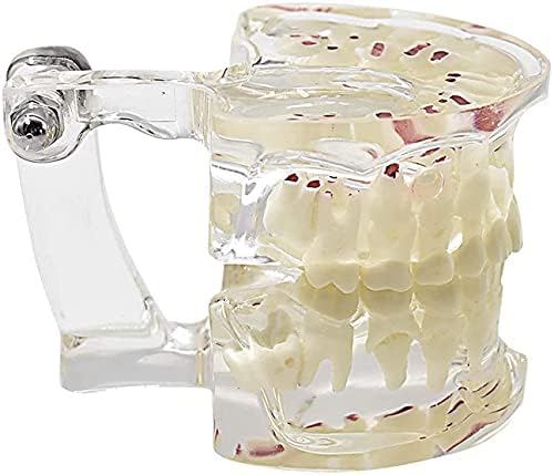 LIYG Зъби Модел Деца, Прозрачни Стоматологични Демонстрационни Зъби Модел, Typodont Образователна Модел 9x6.2x6.8 см /