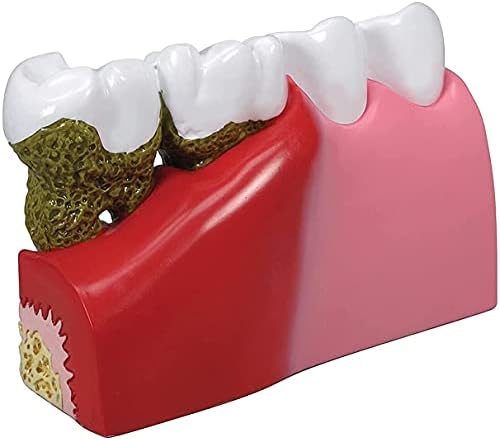 Модел на зъбите, Стоматологичен Модел Анатомия на Човешкото Тяло Реплика на зъбите w/Обща Патология на Инфраструктурата