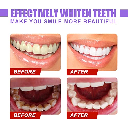 2 елемента Цветен Коректор за Избелване на Зъби за Чувствителни Зъби, Паста за зъби, Четка за Зъби, Паста за зъби Зъб, Почистване на Зъбите Паста за зъби за Избелване