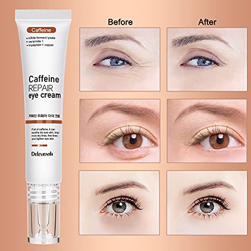 Крем за очи - Крем за очи Против Стареене - Серум за очи Treatment - с колаген, кофеин, полипептидом - за бръчки,Тъмните
