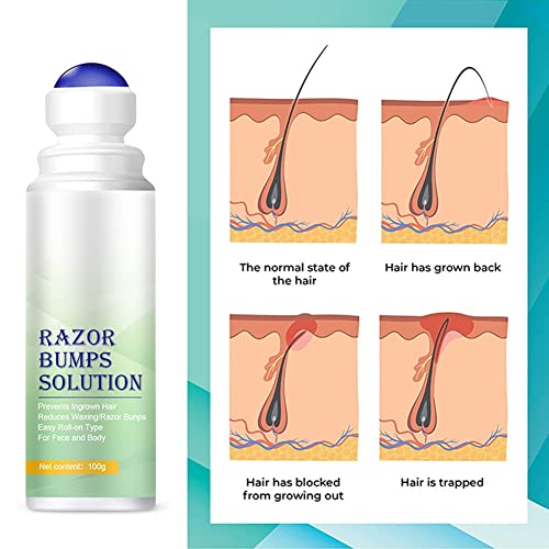 Razor Bump Stopper Solution for Ingrown Hair - Грижи за кожата на лицето, шията, зоната на бикини зоната, краката и подмишниците - Серум за след бръснене за мъже и жени